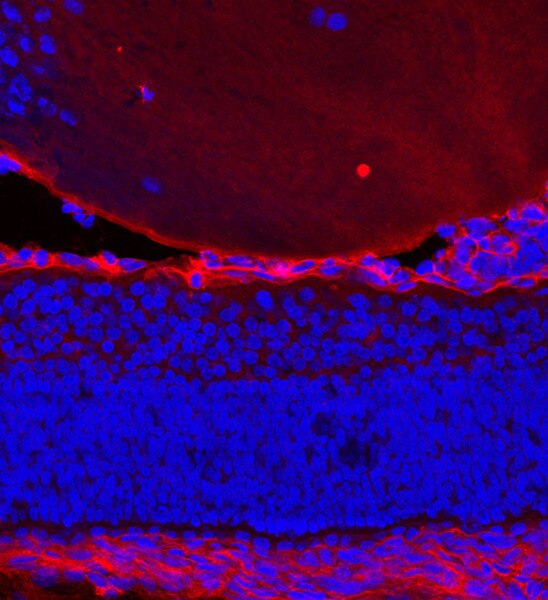 IF of a E 565 mouse lense labeled with DSHB antibody CPTC-SAT1-2 against Spermidine or Spermine N1-Acetyltransferase 1 (red). Image credit: Lachke Laboratory, University of Delaware. 